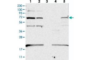 Western blot analysis of Lane 1: RT-4, Lane 2: U-251 MG, Lane 3: Human Plasma, Lane 4: Liver, Lane 5: Tonsil with EEFSEC polyclonal antibody  at 1:250-1:500 dilution. (EEFSEC 抗体)