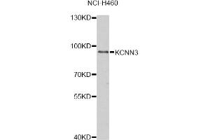 Western blot analysis of extracts of NCI-H460 cells, using KCNN3 antibody. (KCNN3 抗体)