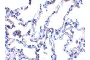 Immunohistochemistry of RRM2B in human lung tissue with RRM2B polyclonal antibody  at 1 ug/mL . (RRM2B 抗体  (AA 2-17))