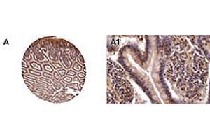 Formalin-fixed, paraffin-embedded normal human colon stained for NOD2 expression. (NOD2 抗体)