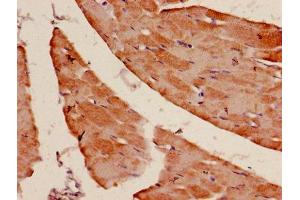 Immunohistochemistry of paraffin-embedded human skeletal muscle tissue using ABIN7143128 at dilution of 1:100 (Actin 抗体  (AA 3-377))