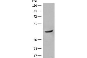 Western blot analysis of Human fetal liver tissue lysate using GCAT Polyclonal Antibody at dilution of 1:400 (GCAT 抗体)