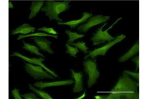 Immunofluorescence of monoclonal antibody to DAPK2 on HeLa cell. (DAPK2 抗体  (AA 281-370))