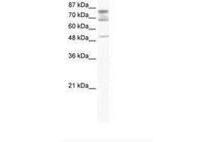 Image no. 1 for anti-DEAD (Asp-Glu-Ala-Asp) Box Polypeptide 46 (DDX46) (C-Term) antibody (ABIN202967) (DDX46 抗体  (C-Term))