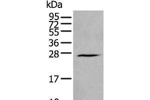Western blot analysis of Human fetal brain tissue lysate using HAND1 Polyclonal Antibody at dilution of 1:400 (HAND1 抗体)