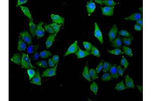 Immunofluorescence staining of Hela cells with ABIN7170160 at 1:33, counter-stained with DAPI. (SLC22A5 抗体  (AA 42-142))