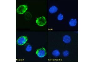 Immunofluorescence staining of fixed Jurkat cells with anti-CD7 antibody 3A1E. (Recombinant CD7 抗体)