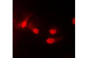 Immunofluorescent analysis of CK1 epsilon staining in HEK293T cells. (CK1 epsilon 抗体  (Center))