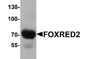 Western blot analysis of FOXRED2 in human lung tissue lysate with FOXRED2 antibody at 1 µg/mL. (FOXRED2 抗体  (N-Term))