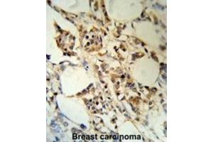 Immunohistochemistry (IHC) image for anti-RNA Binding Motif Protein 3 (RBM3) antibody (ABIN3003187) (RBM3 抗体)