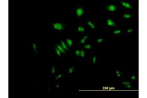 Immunofluorescence of purified MaxPab antibody to NVL on HeLa cell. (NVL 抗体  (AA 1-659))