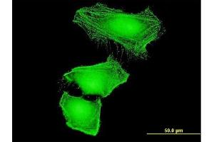 Immunofluorescence of monoclonal antibody to CUL2 on HeLa cell. (Cullin 2 抗体  (AA 1-100))