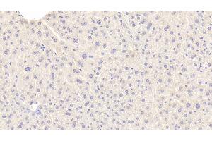Immunohistochemistry (IHC) image for anti-alpha-1-B Glycoprotein (A1BG) (AA 313-512) antibody (ABIN7437173)