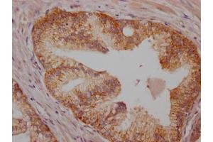 Immunohistochemistry (IHC) image for anti-B-Raf proto-oncogene, serine/threonine kinase (BRAF) antibody (ABIN7127359)