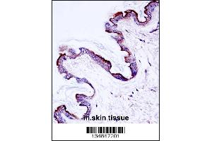 Mouse Prkch Antibody immunohistochemistry analysis in formalin fixed and paraffin embedded mouse skin tissue followed by peroxidase conjugation of the secondary antibody and DAB staining. (PKC eta 抗体  (AA 314-341))
