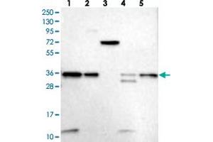 Western blot analysis of Lane 1: RT-4, Lane 2: U-251 MG, Lane 3: Human Plasma, Lane 4: Liver, Lane 5: Tonsil with VPS37B polyclonal antibody .