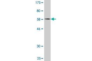 Western Blot detection against Immunogen (60. (PDXK 抗体  (AA 1-312))
