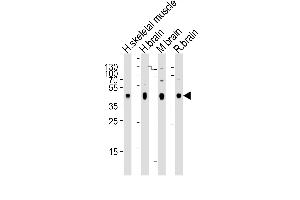 Western blot analysis of lysates from human skeletal muscle, human brain, mouse brain, rat brain tissue (from left to right), using PDK2 Antibody (ABIN659060 and ABIN2838063). (PDK2 抗体)