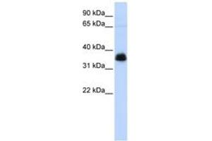 Image no. 1 for anti-Aryl Hydrocarbon Receptor Interacting Protein (AIP) (AA 36-85) antibody (ABIN6744248) (AIP 抗体  (AA 36-85))
