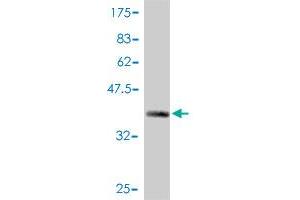 Western Blot detection against Immunogen (37. (MSH2 抗体  (AA 835-934))