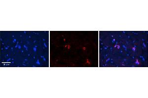 Rabbit Anti-NRF1 Antibody    Formalin Fixed Paraffin Embedded Tissue: Human Adult heart  Observed Staining: Nuclear Primary Antibody Concentration: 1:600 Secondary Antibody: Donkey anti-Rabbit-Cy2/3 Secondary Antibody Concentration: 1:200 Magnification: 20X Exposure Time: 0.
