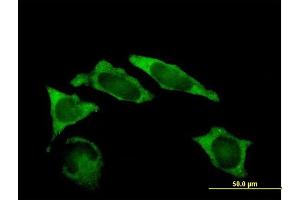 Immunofluorescence of purified MaxPab antibody to IMP-2 on HeLa cell. (IGF2BP2 抗体  (AA 1-598))