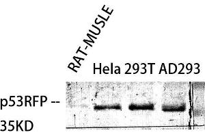 Western Blot (WB) analysis of specific cells using p53RFP Polyclonal Antibody. (RNF144B 抗体  (Internal Region))
