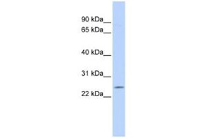 WB Suggested Anti-PSMB5 Antibody Titration: 0. (PSMB5 抗体  (Middle Region))
