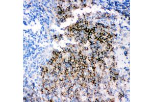 Anti- CD79B picoband antibody,IHC(P) IHC(P): Rat Spleen Tissue (CD79b 抗体  (AA 29-229))
