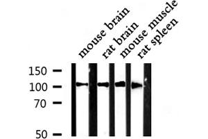 Western blot analysis of Actin α-2/3 expression in various lysates (ACTN3 抗体  (N-Term))