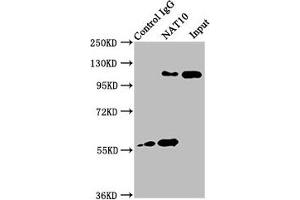 Western Blotting (WB) image for anti-N-Acetyltransferase 1 (Arylamine N-Acetyltransferase) (NAT1) (AA 909-1025) antibody (ABIN7168283)
