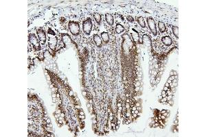 IHC analysis of PTBP1 using anti-PTBP1 antibody (ABIN7599451).