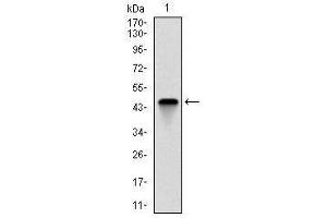 Western Blotting (WB) image for anti-Fast Skeletal Troponin I (TNNI2) antibody (ABIN1107197)