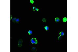 Immunofluorescence staining of MCF-7 cells with ABIN7161502 at 1:166, counter-stained with DAPI. (NCF4 抗体  (AA 136-239))