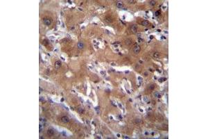 Formalin fixed, paraffin embedded human liver tissue stained with RASSF10 Antibody  followed by peroxidase conjugation of the secondary antibody and DAB staining. (RASSF10 抗体  (Middle Region))