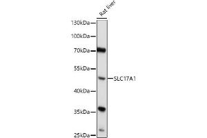 Western blot analysis of extracts of Rat liver, using SLC17 antibody (6642) at 1:1000 dilution. (SLC17A1 抗体  (AA 1-100))