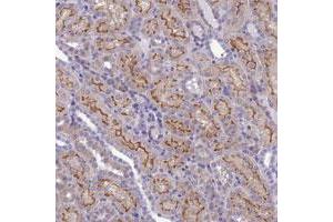 Immunohistochemical staining of human kidney with ANKS4B polyclonal antibody  shows strong membranous positivity in cells in tubules. (ANKS4B 抗体)