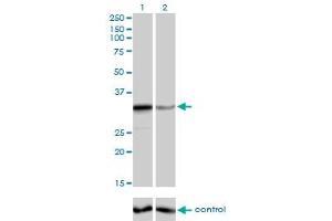 Western blot analysis of ZNF346 over-expressed 293 cell line, cotransfected with ZNF346 Validated Chimera RNAi (Lane 2) or non-transfected control (Lane 1). (ZNF346 抗体  (AA 133-232))