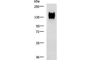 Western blot analysis of A549 cell lysate using CEACAM1 Polyclonal Antibody at dilution of 1:500 (CEACAM1 抗体)