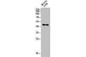Western Blotting (WB) image for anti-Killer Cell Immunoglobulin-Like Receptor, three Domains, Long Cytoplasmic Tail, 1 (KIR3DL1) (N-Term) antibody (ABIN7188599)