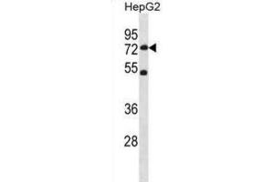 Western Blotting (WB) image for anti-SET Domain Containing 3 (SETD3) antibody (ABIN3001114)