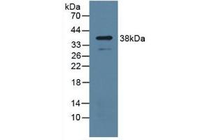 Detection of UPP1 in Mouse Lung Tissue using Polyclonal Antibody to Uridine Phosphorylase 1 (UPP1) (UPP1 抗体  (AA 1-277))