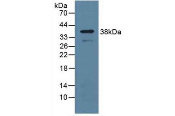 UPP1 抗体  (AA 1-277)