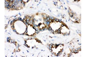 Immunohistochemistry (IHC) image for anti-Transmembrane Protein 173 (TMEM173) (AA 284-316), (C-Term) antibody (ABIN3043423)