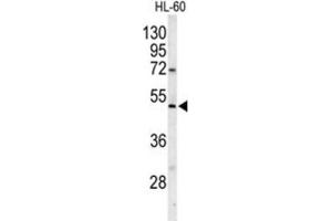 Western Blotting (WB) image for anti-Polymerase (DNA Directed), gamma 2, Accessory Subunit (POLG2) antibody (ABIN3001661) (POLG2 抗体)