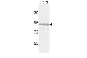 Western blot analysis of TYRO10 Antibody (ABIN392069 and ABIN2841832) in Jurkat(lane 1), 293(lane 2) and Hela(lane 3) cell line lysates (35 μg/lane). (DDR2 抗体)