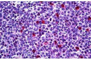 Human Tonsil: Formalin-Fixed, Paraffin-Embedded (FFPE) (CDKN1B 抗体  (AA 1-199))