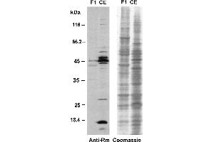 Western blot analysis of proteins from the eyespot fraction F1 and a CE with the anti-methyl-arginine specific antibody 7E6. (Methylated Arginine (MMA+ADMA+SDMA) 抗体)