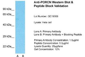 Host: Rabbit  Target Name: PORCN  Sample Tissue: Hela Whole cell  Lane A:  Primary Antibody Lane B:  Primary Antibody + Blocking Peptide Primary Antibody Concentration: 1 µg/mL Peptide Concentration: 5 µg/mL Lysate Quantity: 41 µg/laneGel Concentration:. (PORCN 抗体  (N-Term))