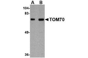 Image no. 1 for anti-Translocase of Outer Mitochondrial Membrane 70 (TOMM70A) (Internal Region) antibody (ABIN341714) (TOM70 抗体  (Internal Region))